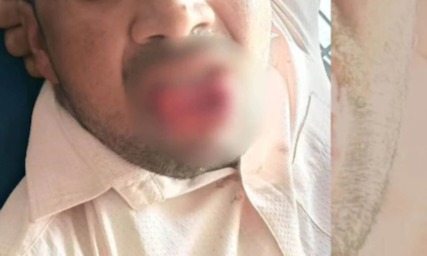  Woman bites off ex-boyfriend’s tongue after he forces her to kiss 