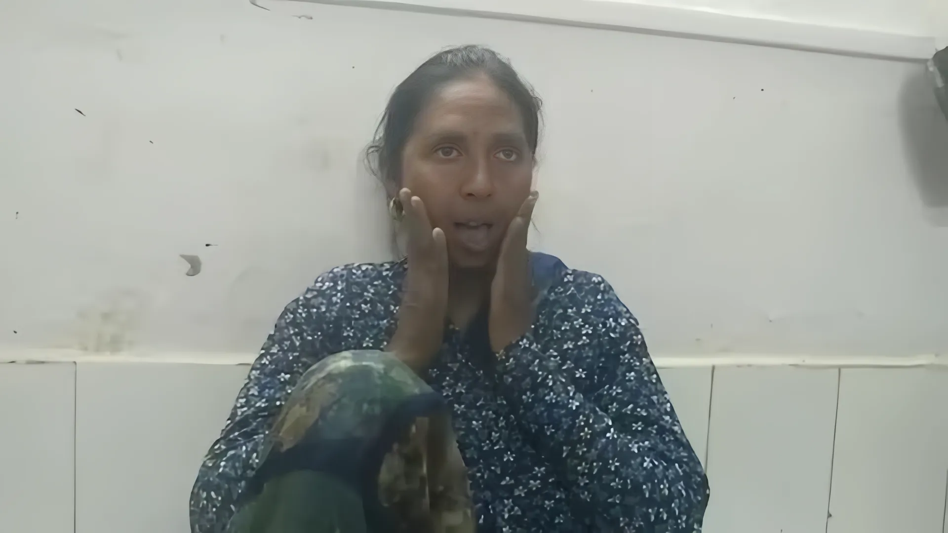  Golgappa eating turns painful as UP woman’s mouth gets stuck open | Watch 