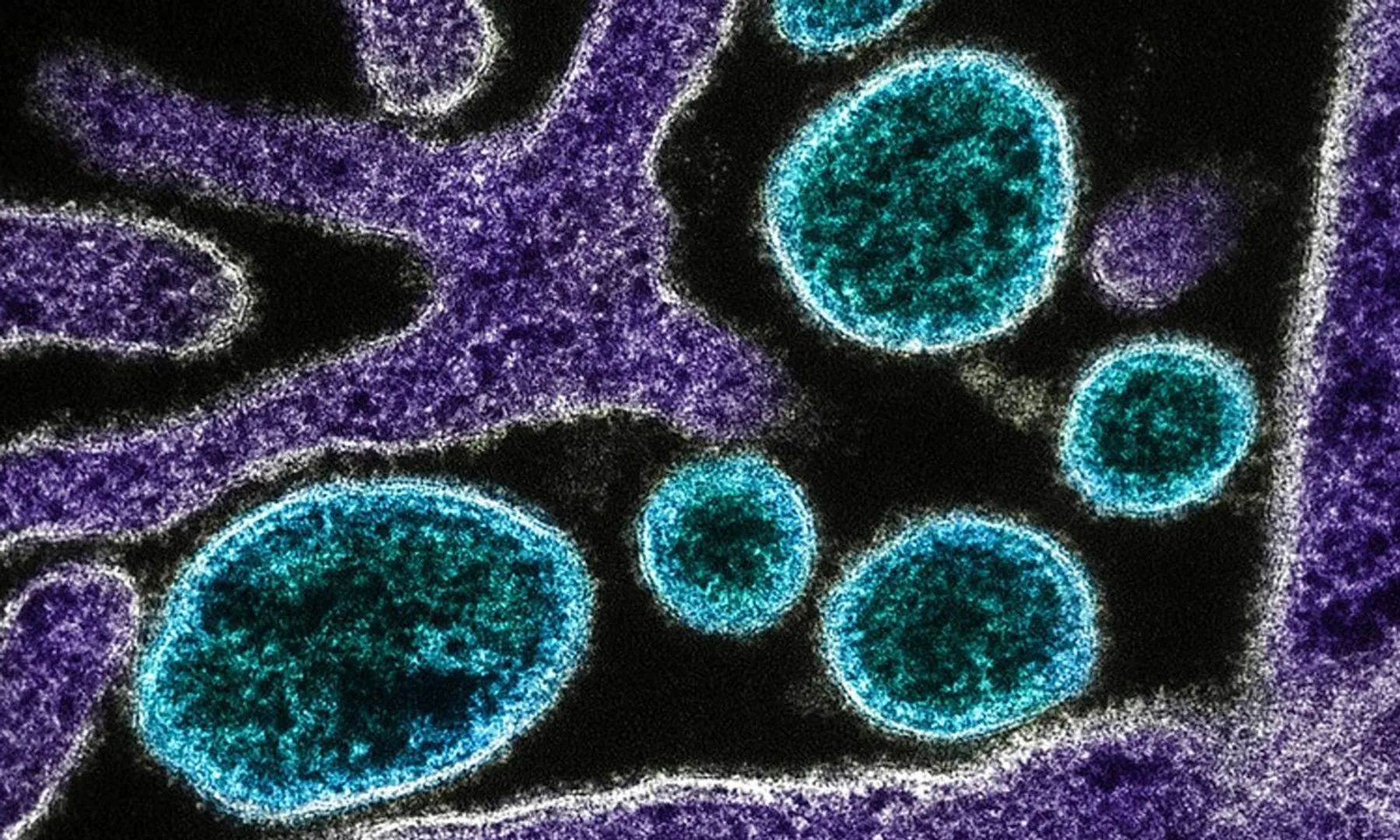  Nipah Virus explained: What we know about deadly disease with no cure 