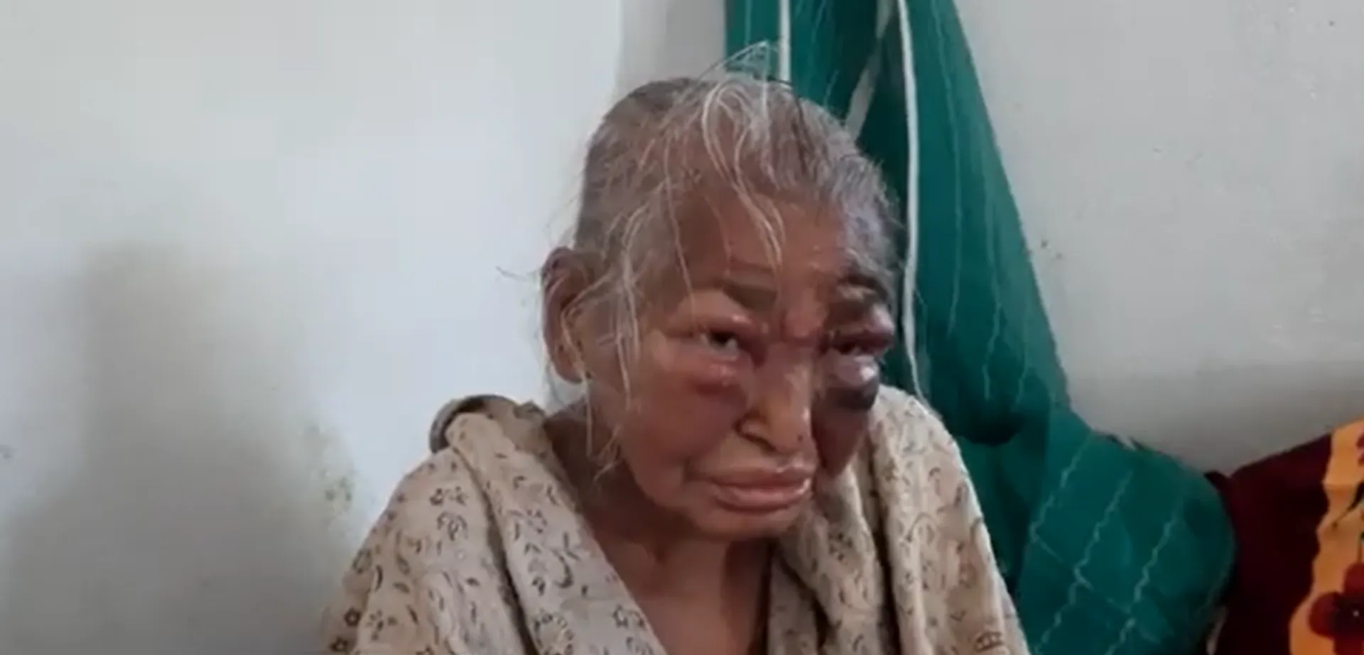 80-year-old woman assaulted by TMC goons because her son joined BJP: Mamata Banerjee's regime is bound to end