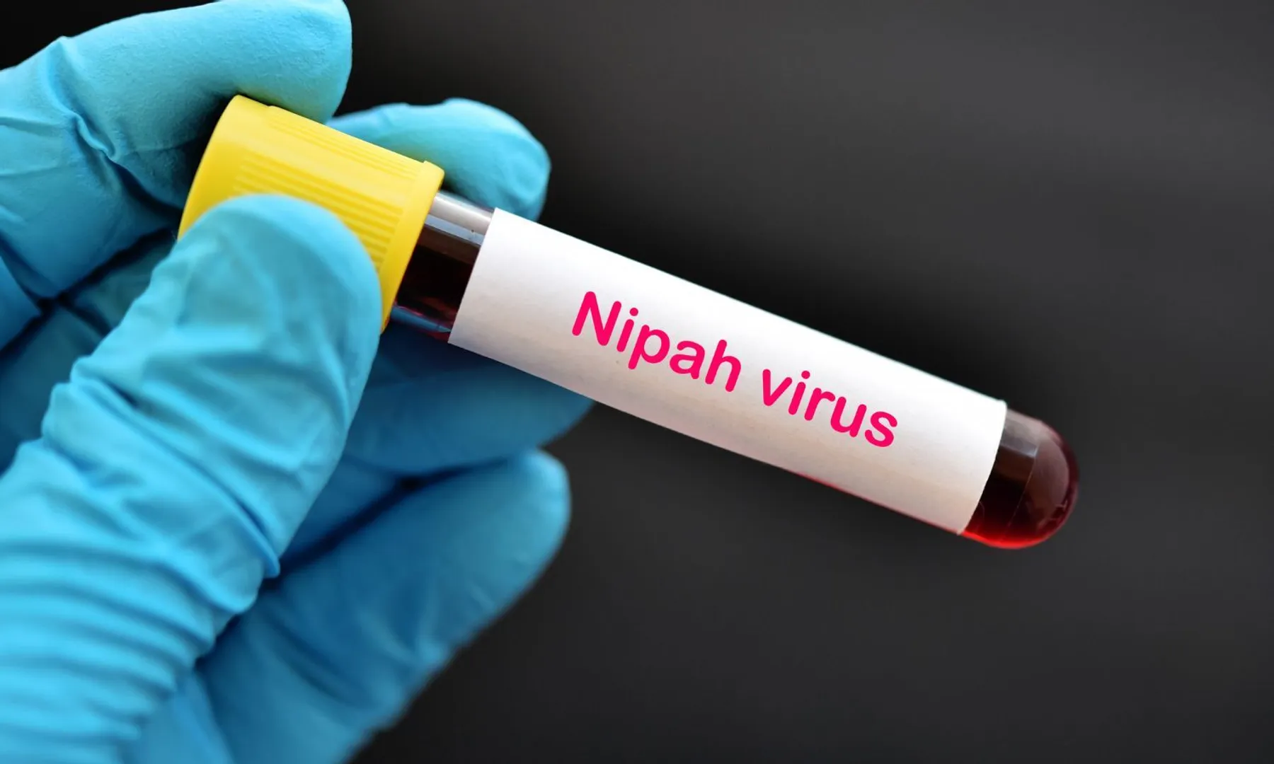 Nipah: The Kerala government boosts its virus prevention measures