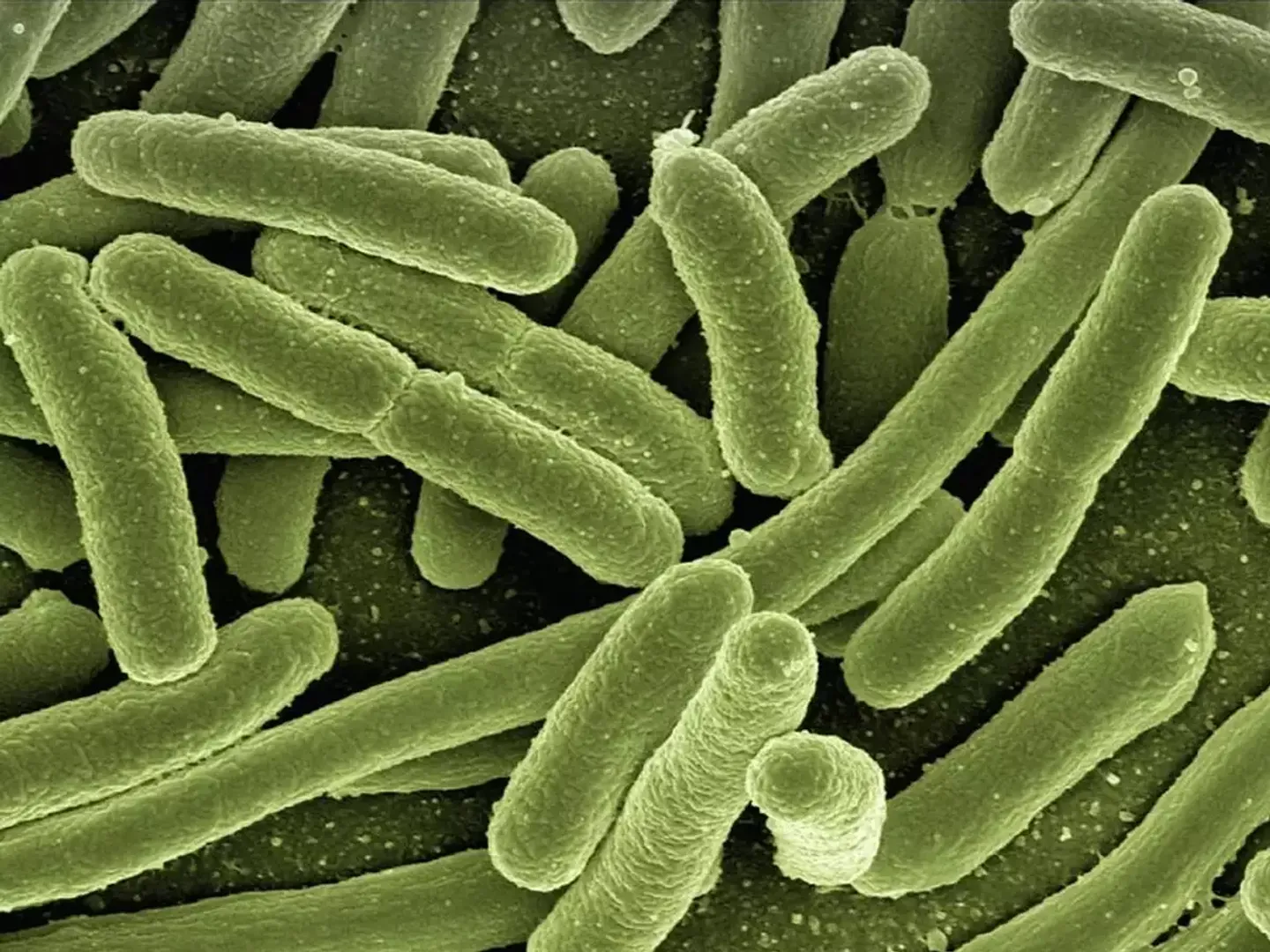 Deadly bacteria infection claims five lives in Shimla