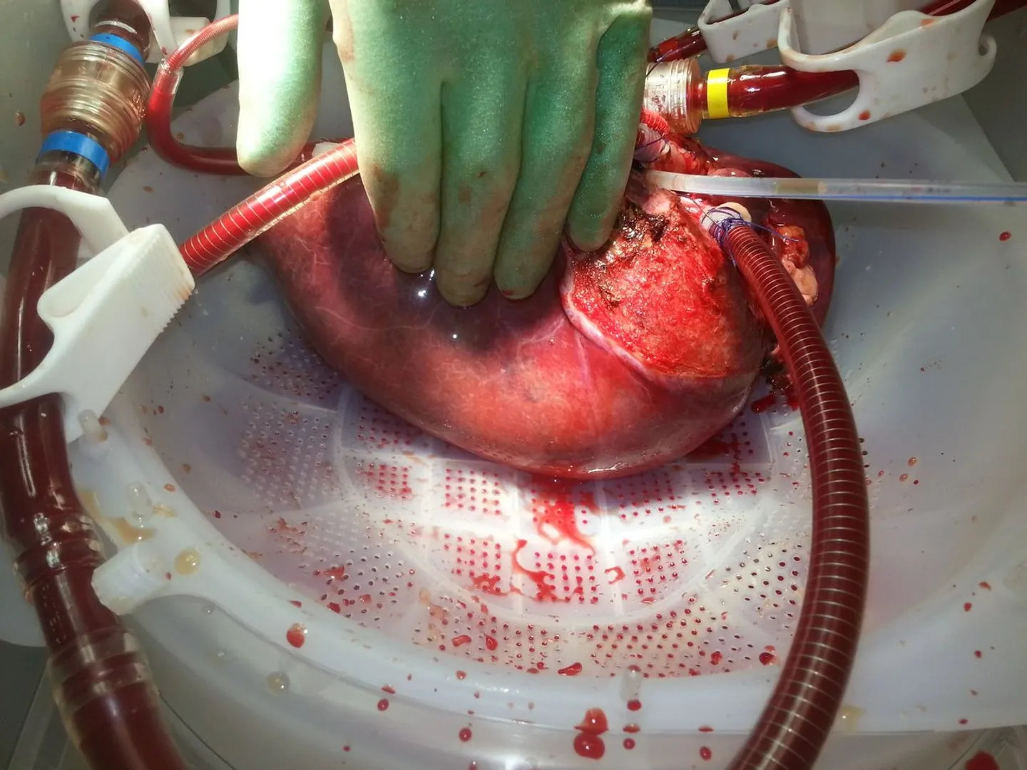 China is developing an artificial liver that works even outside human body: Report