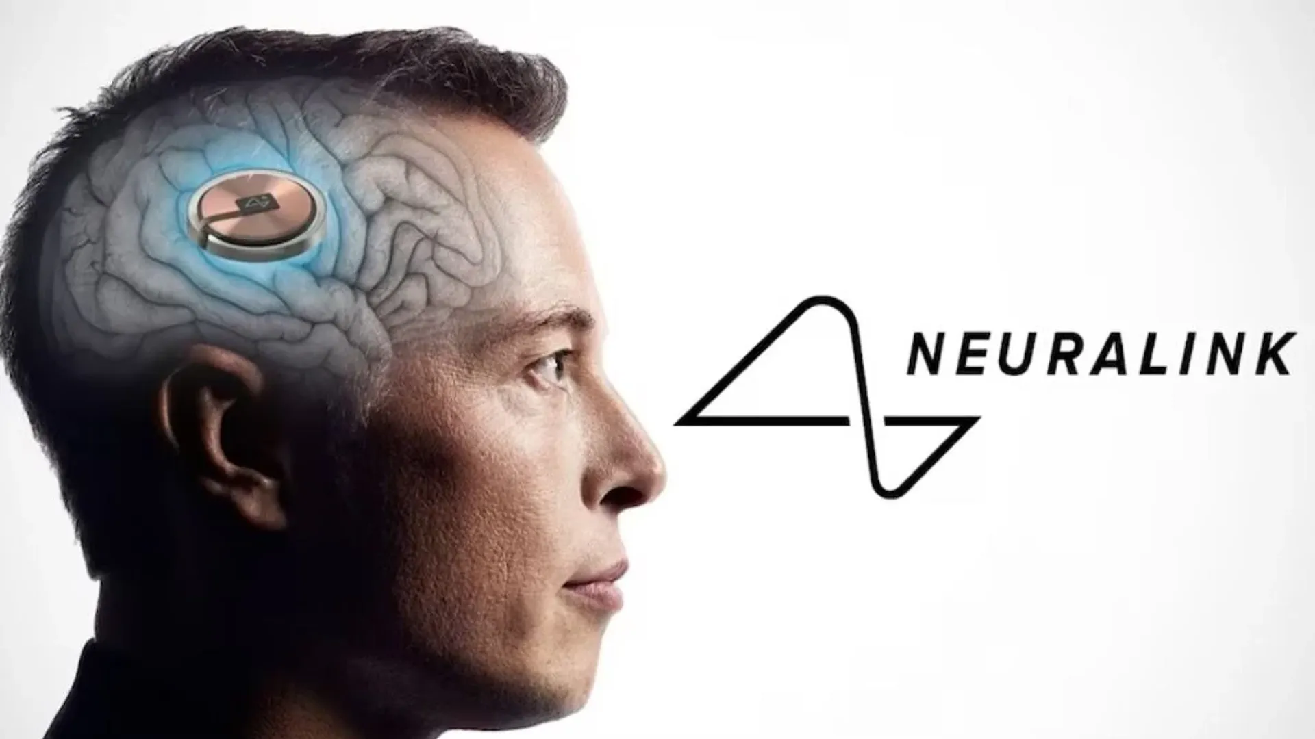 Neuralink, founded by Elon Musk, begins human trial, testing to start with paralysis patients