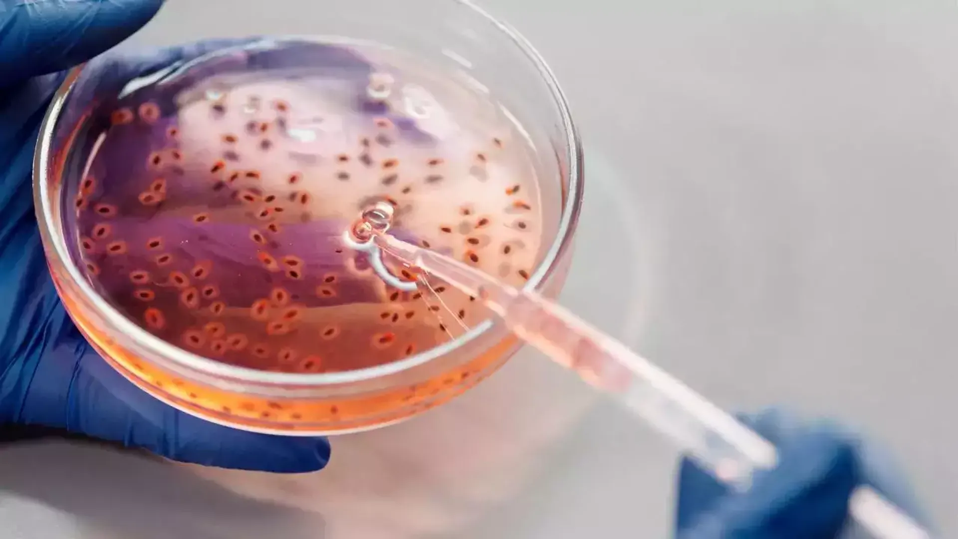 Zombie viruses from 50,000 years ago may awaken due to climate change