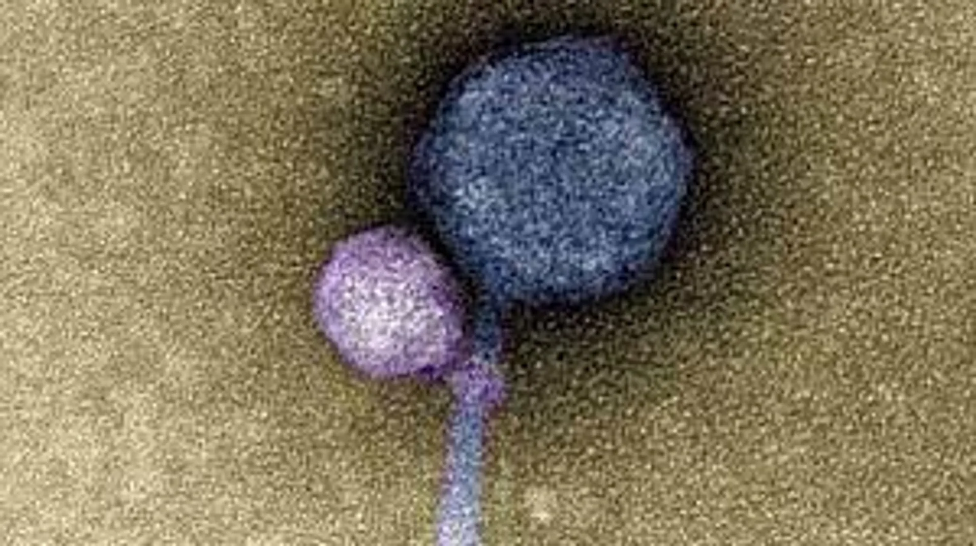 First evidence of 'vampire viruses' found in the US; Discover more