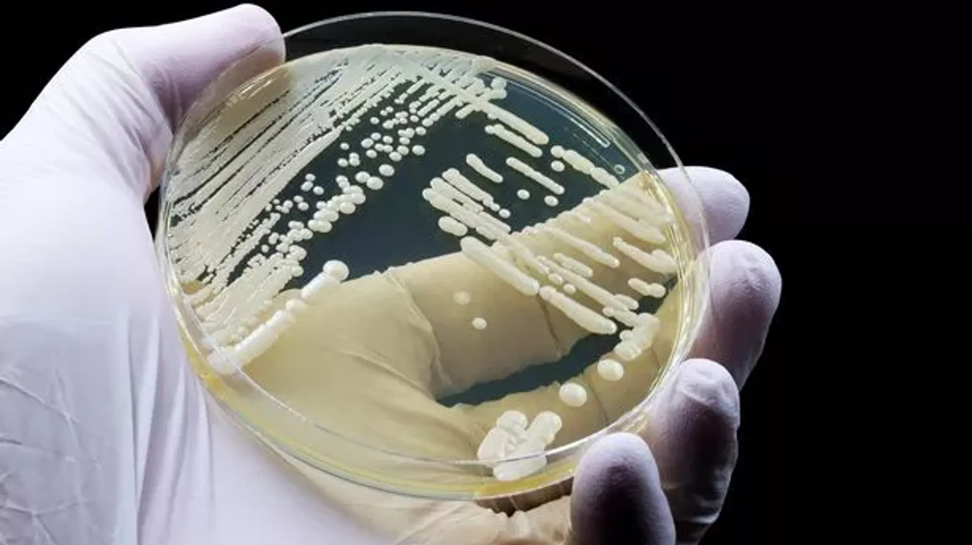 Candida Auris, a Deadly Fungal Infection, is Spreading Fast in the US