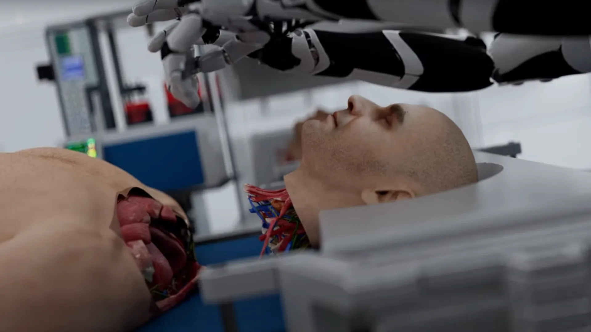 Video showing head transplants on brain-dead bodies using AI grabs netizens attention