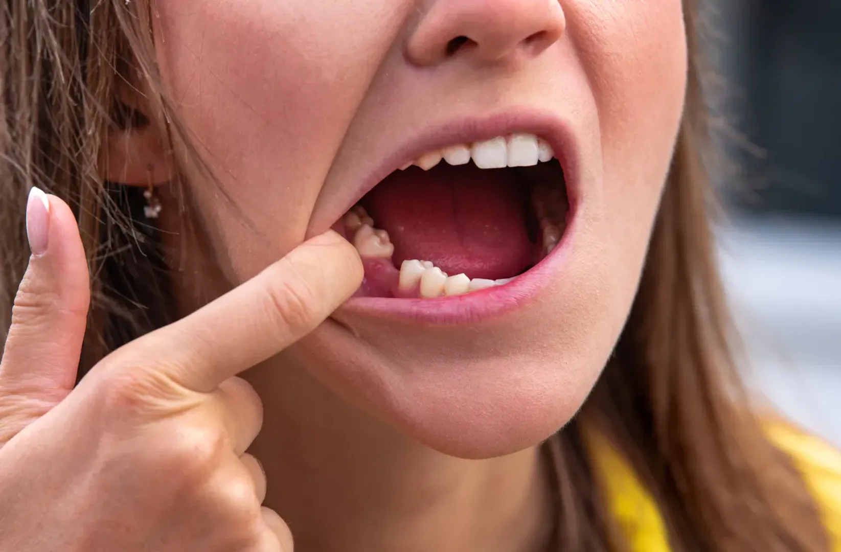 tooth
