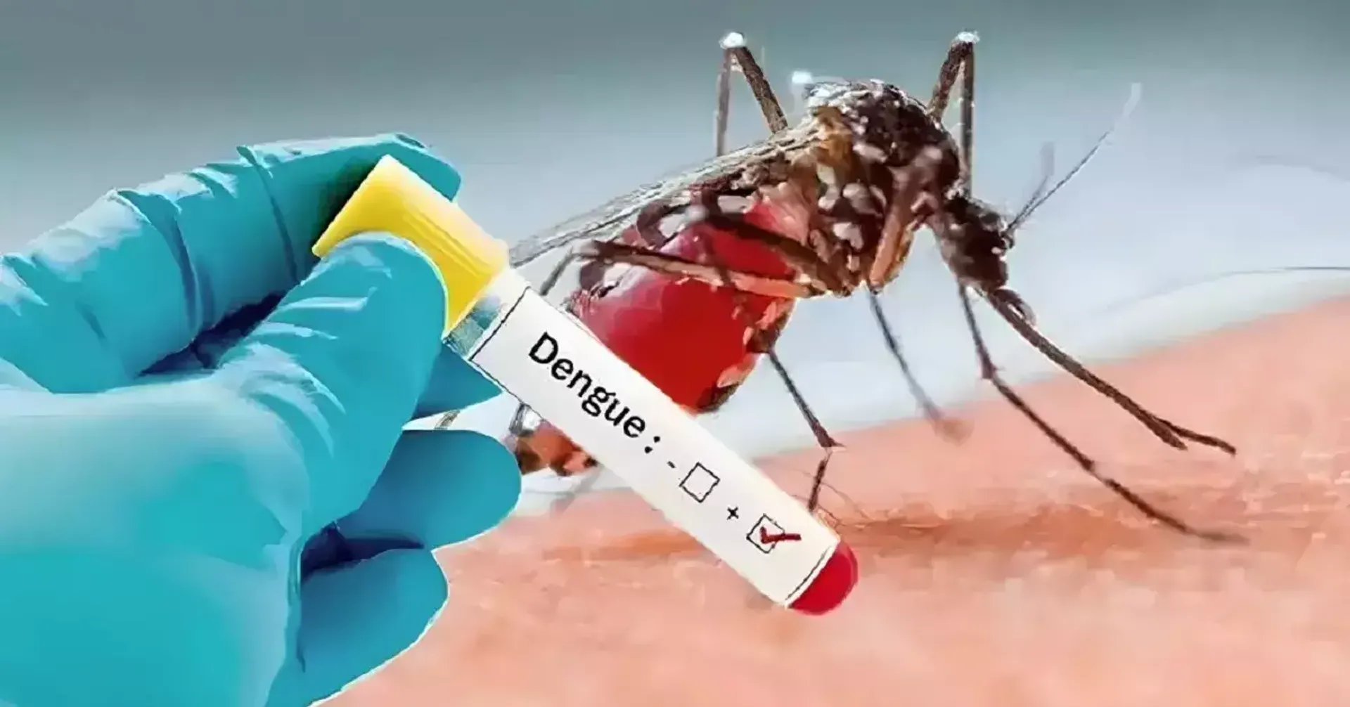 Doctors say Dengue can have serious effects on the nervous system and brain