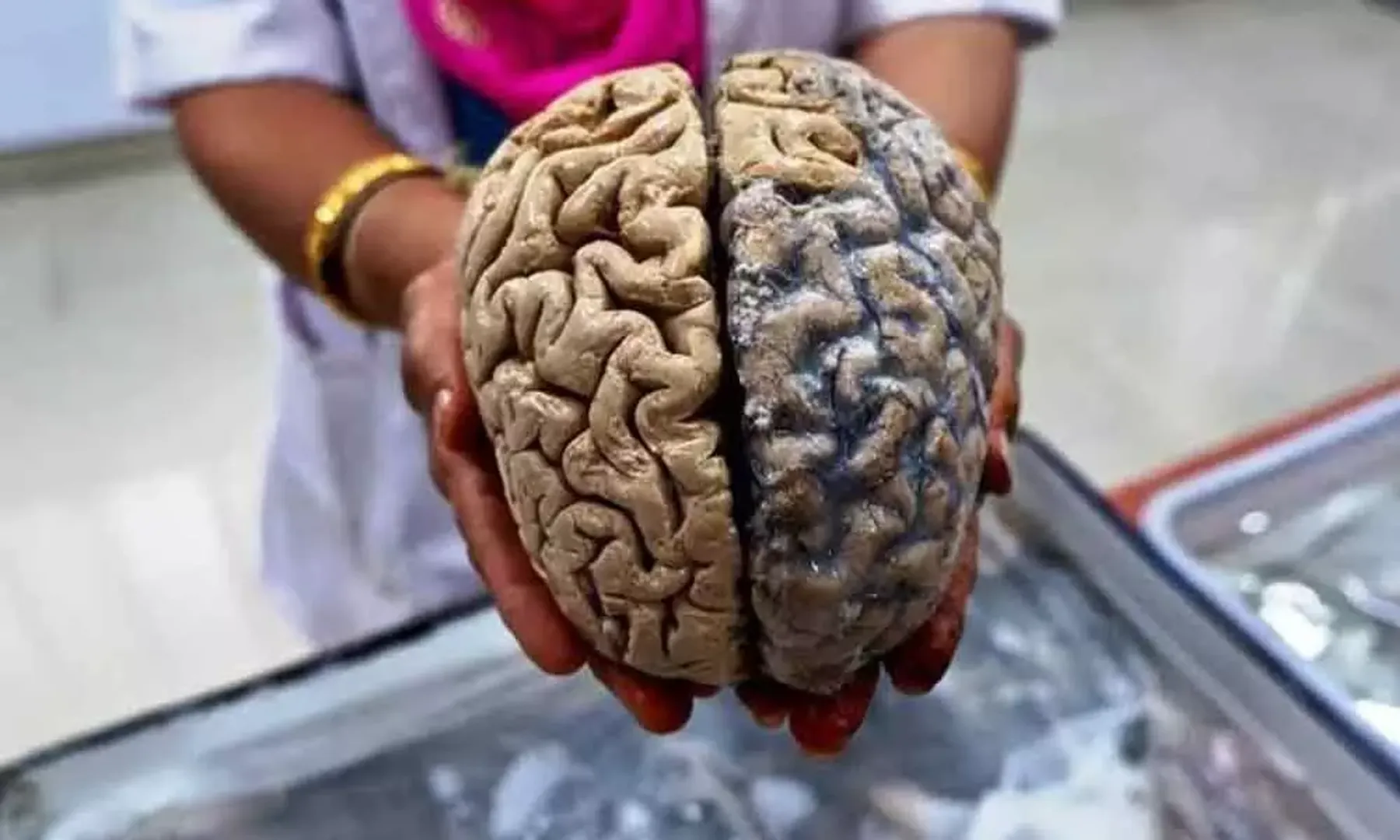 brain