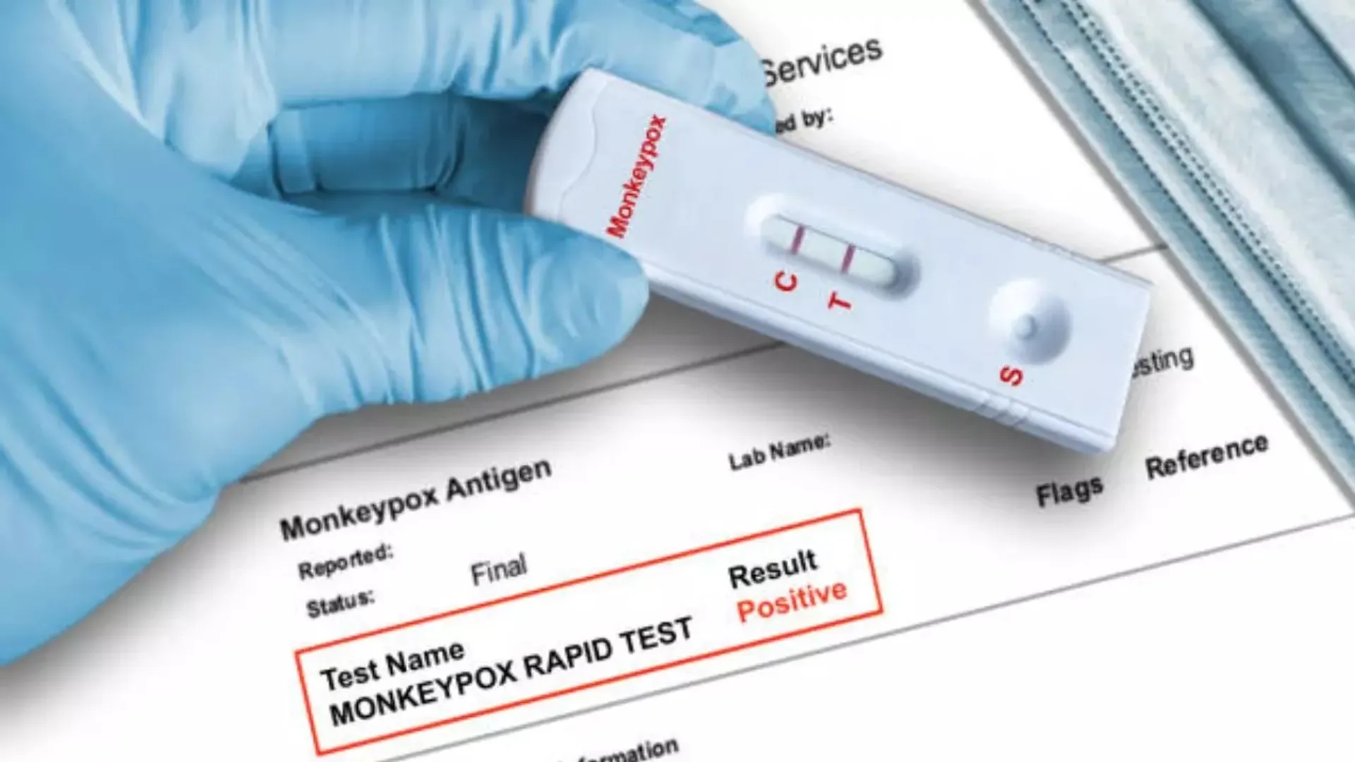 India’s indigenous Monkeypox RT-PCR testing kit receives CDSCO approval