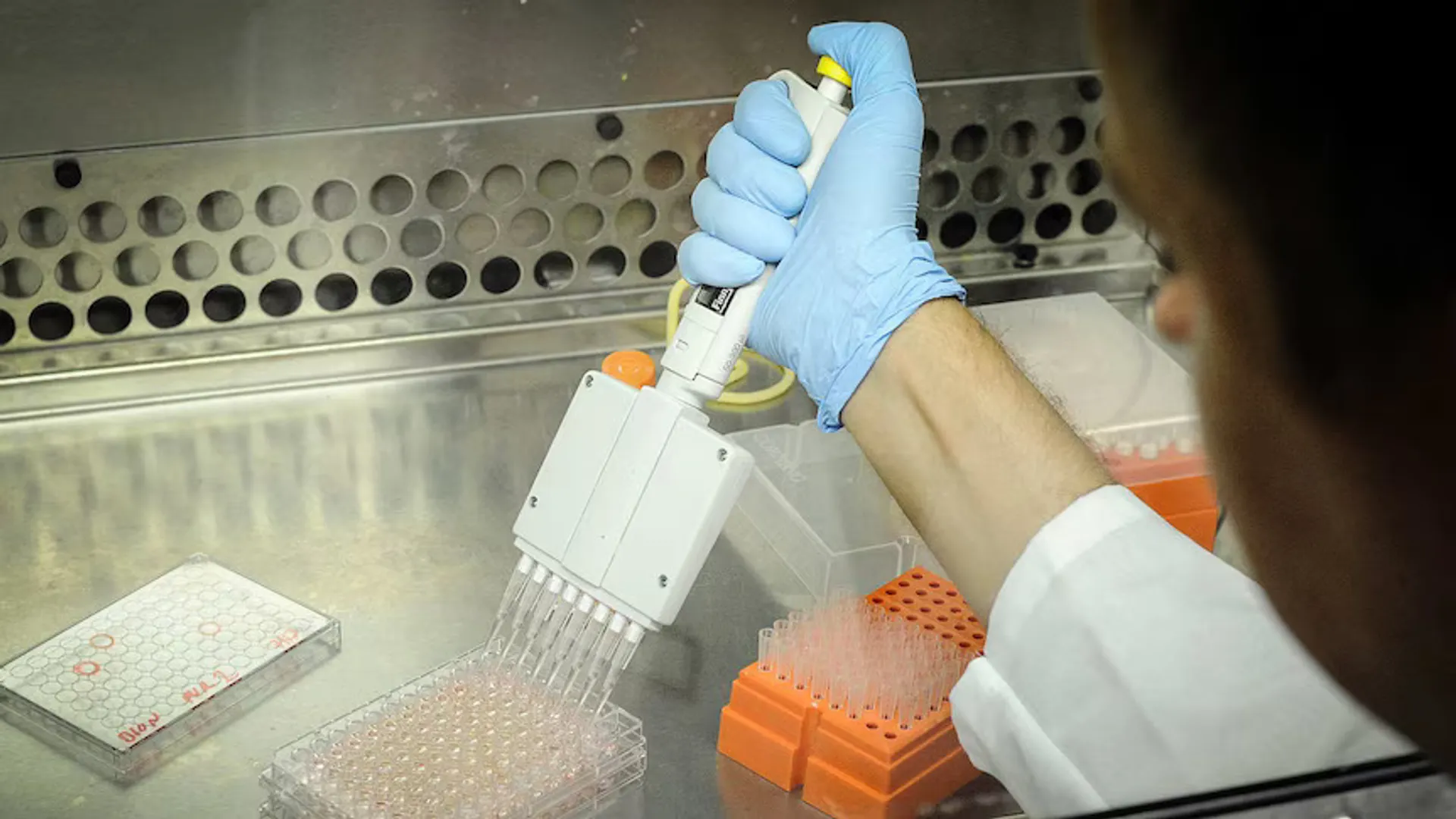 After 100 years of theories, scientists find healing cells that could transform chronic wound treatment