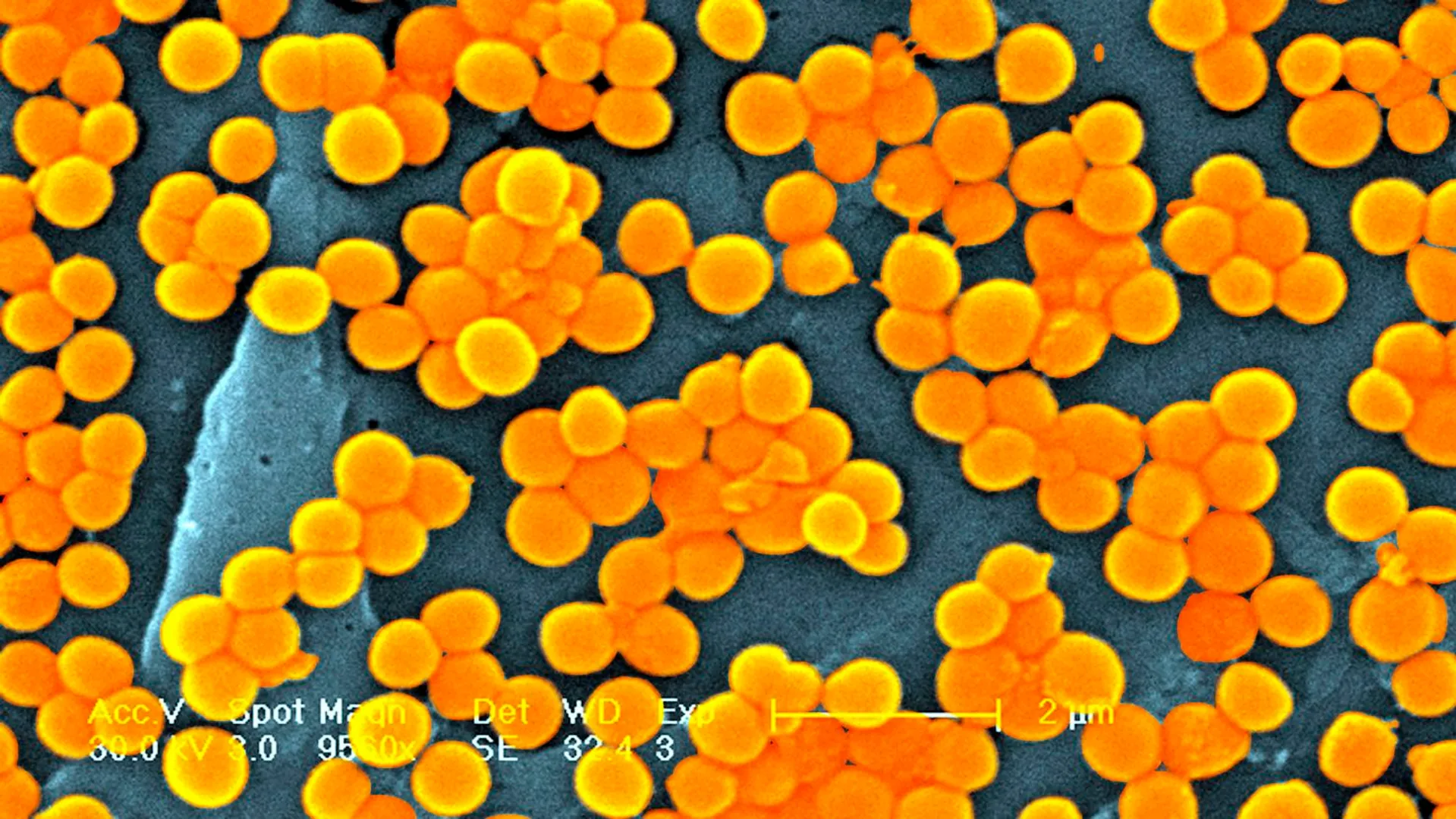 Over 40 million people might die from superbugs by 2050: Study