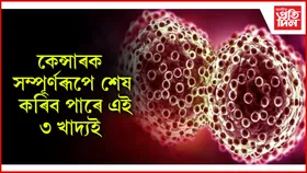 খাদ্যৰ বাবেই হয় বহু ৰোগ, খাওঁতে সাৱধান হওঁক