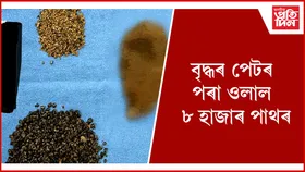 আচৰিত ! ইশ্বৰৰ কৃপাতহে প্ৰাণ ৰক্ষা এইজনৰ