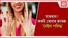নেইল পলিছৰ পাৰ্শ্বক্ৰিয়াৰ পৰা কেনেকৈ বাচি থাকিব পাৰি জানি লওঁক