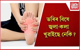 ঔষধ খাব নালাগে, এইদৰে ঘৰতে কৰক ভৰিৰ বিষৰ চিকিৎসা