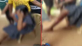 15-yr-old girl set on fire in Odisha's Puri, treatment at AIIMS Bhubaneswar