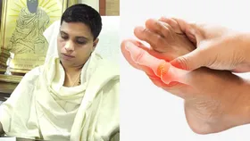आचार्य बालकृष्ण ने बताए यूरिक एसिड से राहत पाने के सबसे आसान उपाय, अपनाने से जल्द मिलेगा आराम