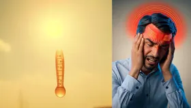 चिलचिलाती गर्मी में सिरदर्द से बचने के लिए अपनाएं ये टिप्स, मिलेगा आराम