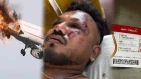 टेक-ऑफ के 30 सेकंड बाद अचानक जोरदार धमाका...प्लेन क्रैश में बचे शख्स ने बताया हादसे का सच