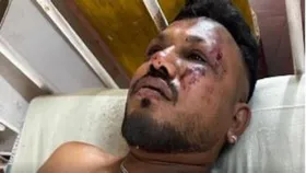 Ahmedabad Plane Crash: विमान हादसे में जीवित शख्स का आया बयान, ऐसे बचाई जान