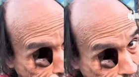एक आंख नहीं है, अंदर बाहर कर लेता है अंगुली, देखकर भी नहीं होगा यकीन