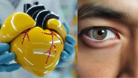 Cholesterol Detection: आंखों में छिपा है कोलेस्ट्रॉल बढ़ने का राज, इन 4 बदलाव से करें पहचान