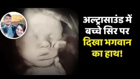 क्या अल्ट्रासाउंड में बच्चे के सिर पर दिखा भगवान का हाथ?  वायरल पोस्ट में किया जा रहा दावा