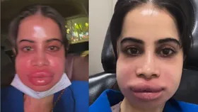इस एक्ट्रेस के एक फैसले ने बिगाड़ दिया पूरा चेहरा, खुद का ऐसा हाल देख रो पड़ीं हसीना