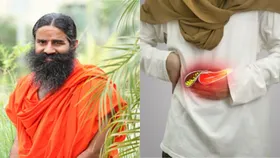 Gall Bladder स्टोन को बिना ऑपरेशन इस तरीके से करें ठीक, बाबा रामदेव ने बताया नुस्खा