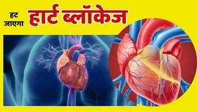 Heart Blockage हटाने में कारगर हैं ये 4 फूड, ऐसे करें इस्तेमाल