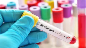 Monkeypox Alert: केरल सामने आया मंकीपॉक्स के संदिग्ध लक्षण वाला मरीज, जांच के लिए भेजे गए नमूने