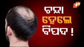 Baldness And Heart Health: ଆପଣଙ୍କ ଚୁଟି ଝଡ଼ୁଛି କି ଧଳା ହେଉଛି କି ? ଭୁଲରେ କରନ୍ତୁ ନାହିଁ ଅଣଦେଖା ...ଭୋଗିପାରନ୍ତି ଗୁରୁତର ସମସ୍ୟା