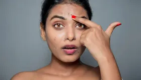 മുഖത്തെ കറുത്ത പാടുകള്‍ മാറ്റാം...
