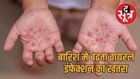 मानसून में बीमारियों का बढ़ा खतरा, तेजी से सामने आ रहे बच्चों में HFMD इंफेक्शन के मामले