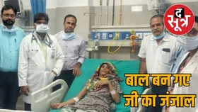 पेट से निकाले 6 किलो बाल :  दर्द की शिकायत लेकर अस्पताल आई थी महिला