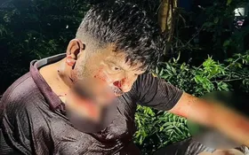 Moradabad: चलती गाड़ी में कहासुनी के बीच किसान पर हमला, गर्दन पर मारा चाकू