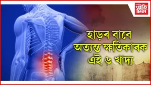 seo  হাড়