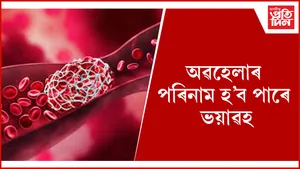  তেজ গোট