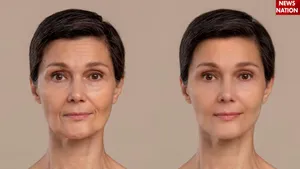 anti-ageing