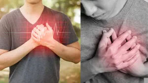 heart attack