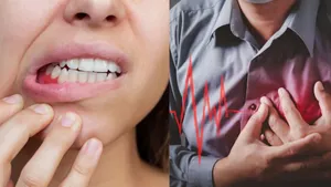 gum disease
