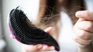 Hair Fall: వర్షాకాలంలో జుట్టు రాలడాన్ని నివారించేందుకు.. సరైన చిట్కాలు ఇవే..!!