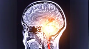 brain x ray post image