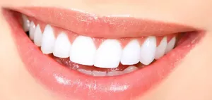 teeth post image