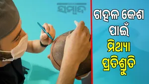 Hair transplant, beauty treatment: Fake doctors are robbing people post image