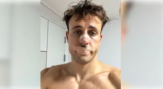 Social media trend of mouth taping during sleep may pose serious risks, shows study