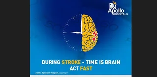 Beat the Silent Killer: Act Fast on World Stroke Day!